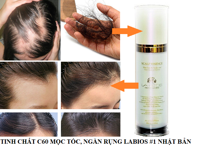 Tinh Chất Chống Rụng & Kích Thích Mọc Tóc Labios Scalp Essence 60ML