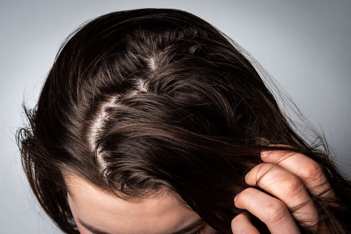 Tóc bị bết là do dầu nhờn trên tóc quá nhiều