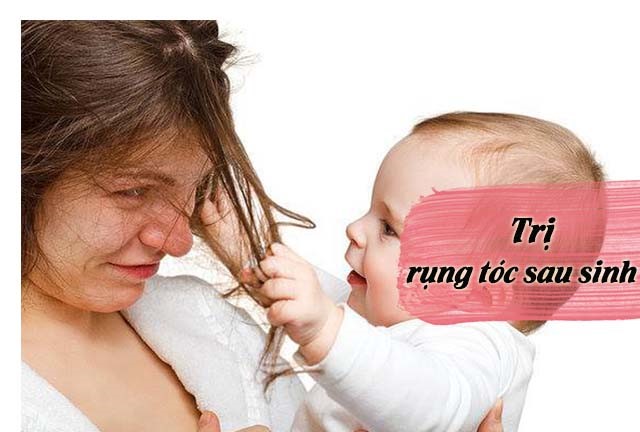 4 MẸO chữa rụng tóc sau sinh tại nhà và 3 loại dầu gội không chứa silicon
